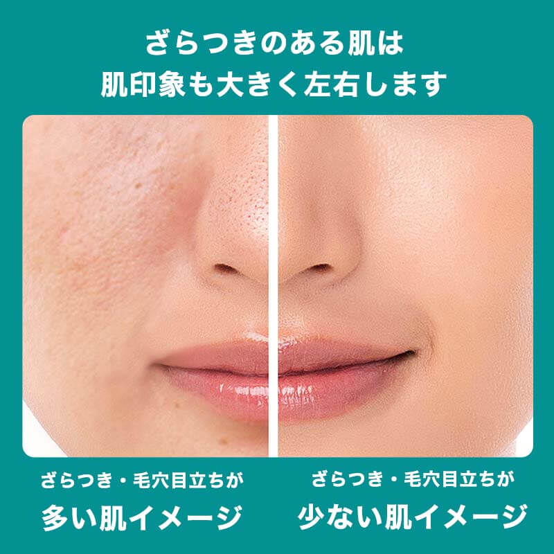 美容液】エファクラ ピールケア セラムの製品情報・口コミ - ラ