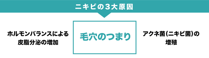 ニキビの3大原因　ホルモンバランスによる皮脂分泌の増加　毛穴のつまり　アクネ菌（ニキビ菌）の増殖