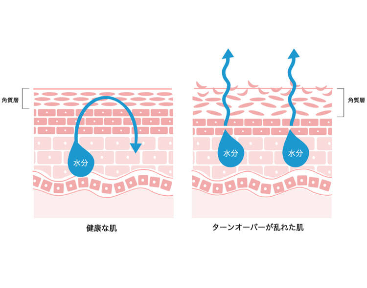 健康な肌 ターンオーバーが乱れた肌 角質層 水分