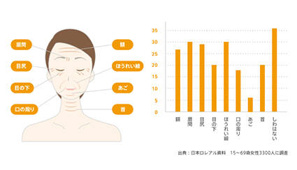 シワのできやすい場所
