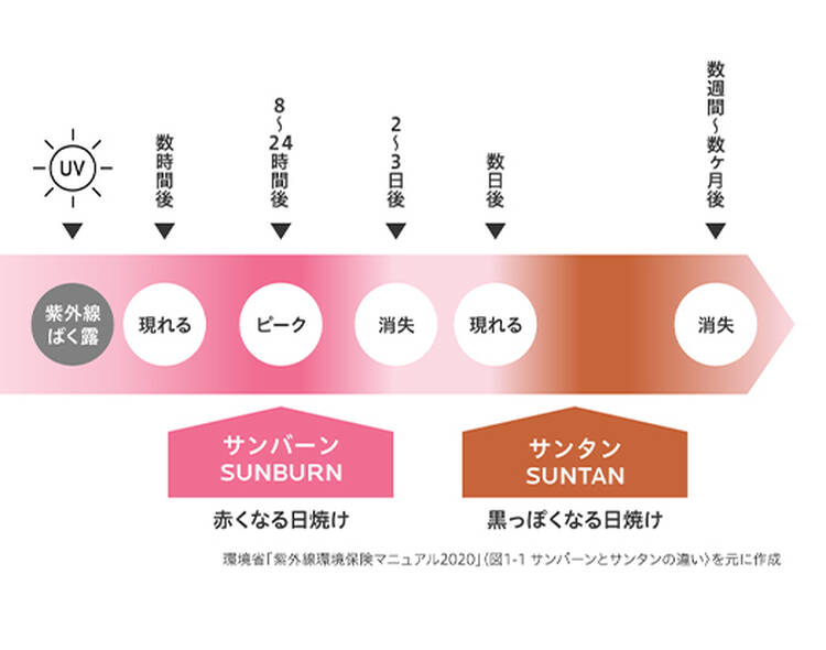 UV 紫外線ばく露 数時間後 現れる 8~24時間後 ピーク 2~3日後 消失 数日後 現れる 数週間~数ヶ月後 消失 サンバーンSUNBURN 赤くなる日焼け サンタンSUNTAN 黒っぽくなる日焼け 環境省「紫外線環境保険マニュアル2020」〈図1-1 サンバーンとサンタンの違い〉を元に作成