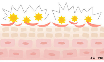 花粉皮膚炎はなぜ起こる？