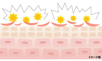 花粉皮膚炎はなぜ起こる?