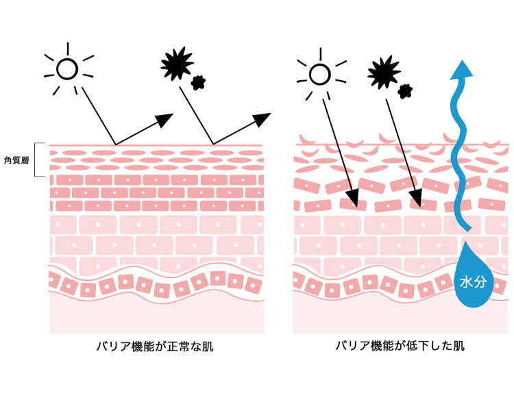 バリア機能が正常な肌 バリア機能が低下した肌 角質層