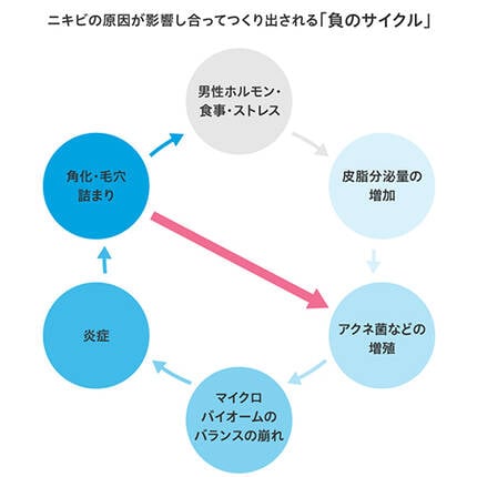面皰(コメド) 皮脂や古い角質による毛穴のつまり