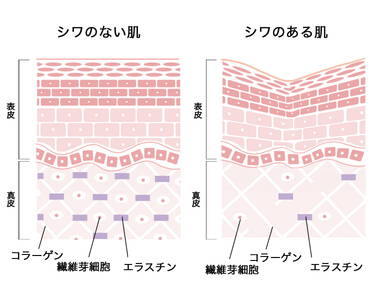肌にじわじわダメージを与える