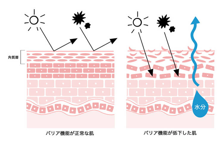 バリア機能の低下 バリア機能が正常な肌 バリア機能が低下した肌