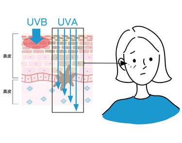 紫外線【UVA】とは?光老化を引き起こすロングUVAを日焼け止めで対策しよう - ラ ロッシュ ポゼ【公式】
