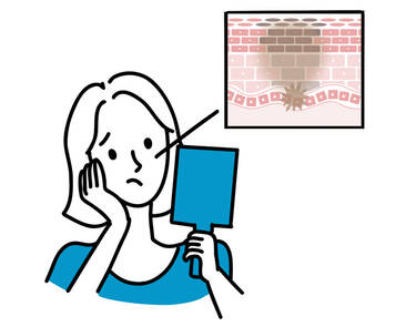 シミの予防法|スキンケアや敏感肌にもおすすめな美白成分、生活習慣を徹底解説