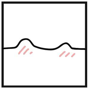 肌荒れ・赤み