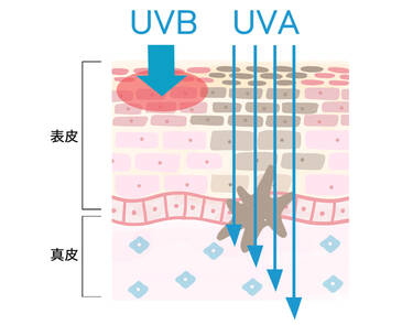 紫外線の種類と肌に与える影響