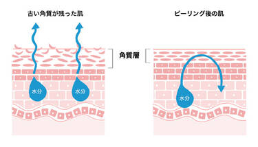 ピーリングとは?