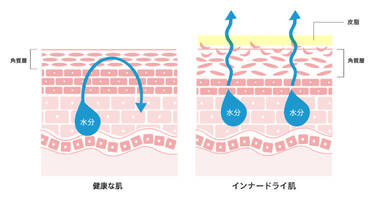 健康な肌 インナードライ肌 角質層 皮脂 水分