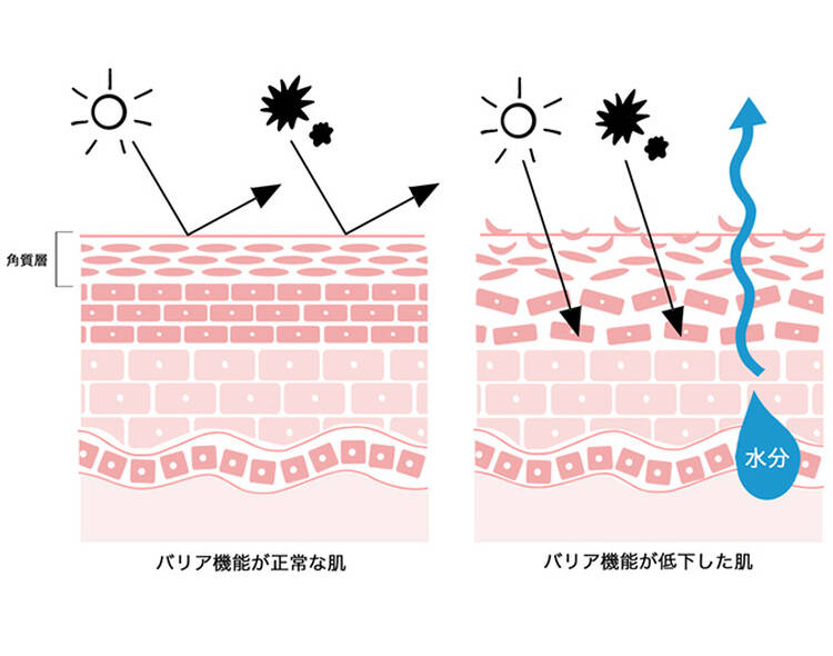 日焼け止めを毎日塗らないことで起こりやすい肌トラブル