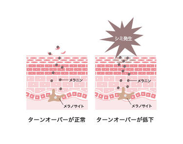 効果③ターンオーバーを促す