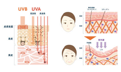 紫外線によるシワ