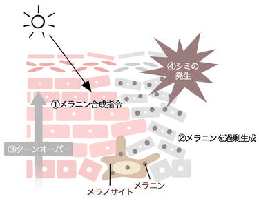 薄い褐色のくすみ│紫外線によるシミ