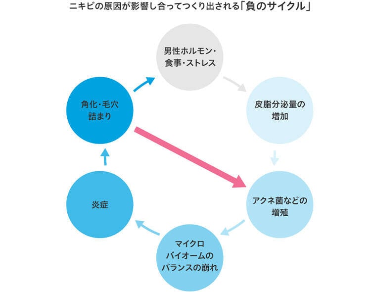 ニキビの悪化サイクルを食い止めるために