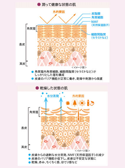 肌に潤いがなくなり、乾燥した状態