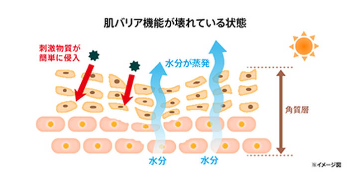 肌バリア機能が壊れている状態