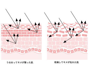 グレーがかったくすみ│乾燥