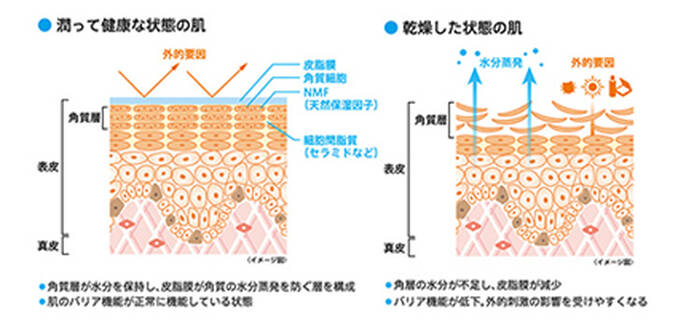 肌のバリア機能とアレルギーとの関係性