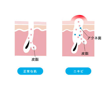主な症状と原因