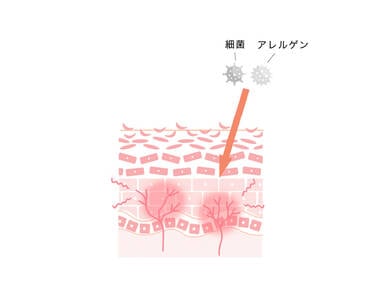 主な症状と原因