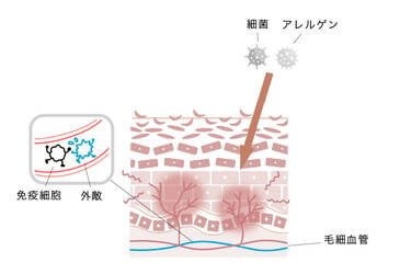 炎症による赤み