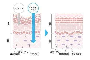 異なるアプローチでシワを改善