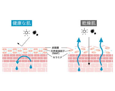 健康な肌 乾燥肌 皮脂膜 天然保湿因子(NMF) セラミド