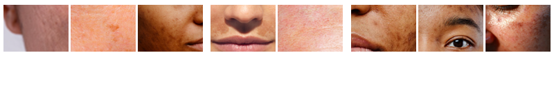 症状例